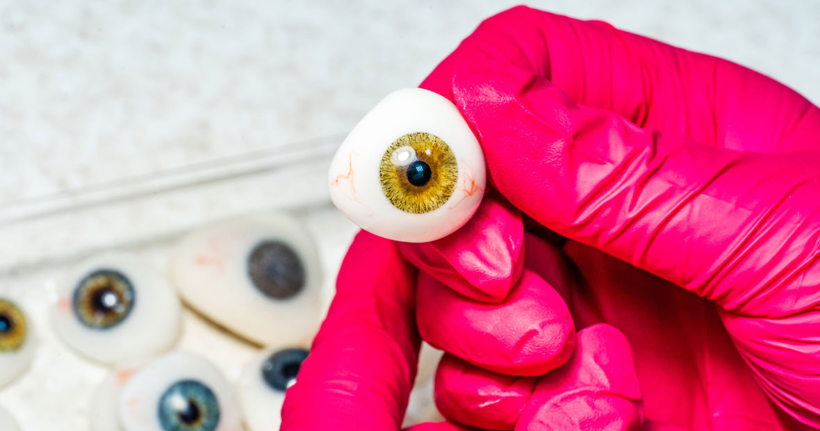prothèses oculaires